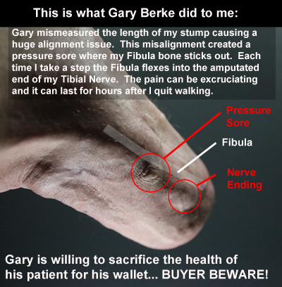 Gary Berke